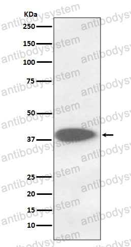 Anti-CTSB Antibody (R1L16)