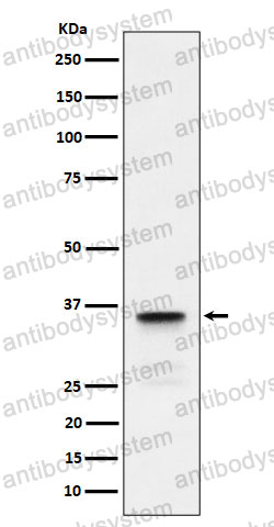 Anti-LDHC Antibody (R1L18)