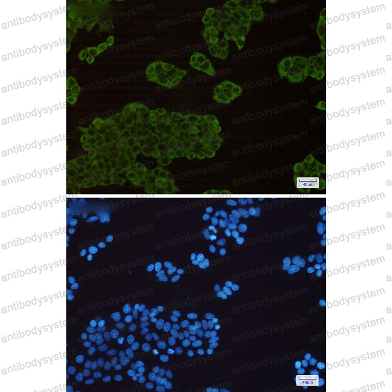 Anti-Hsp90 alpha/beta Antibody (R1L21)