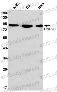 Anti-HSP90AA1 Antibody (R1L20)