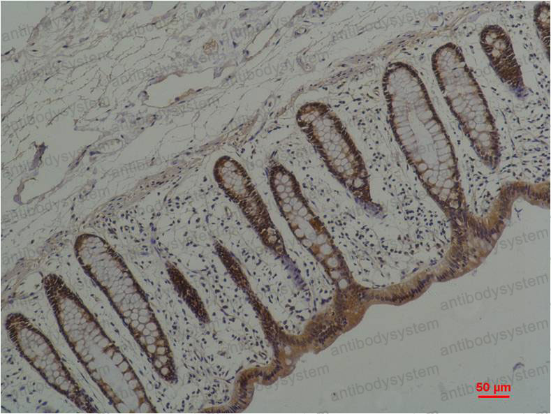 Immunohistochemical for Anti-HSP90AA1 Antibody (R3A37) ?>
