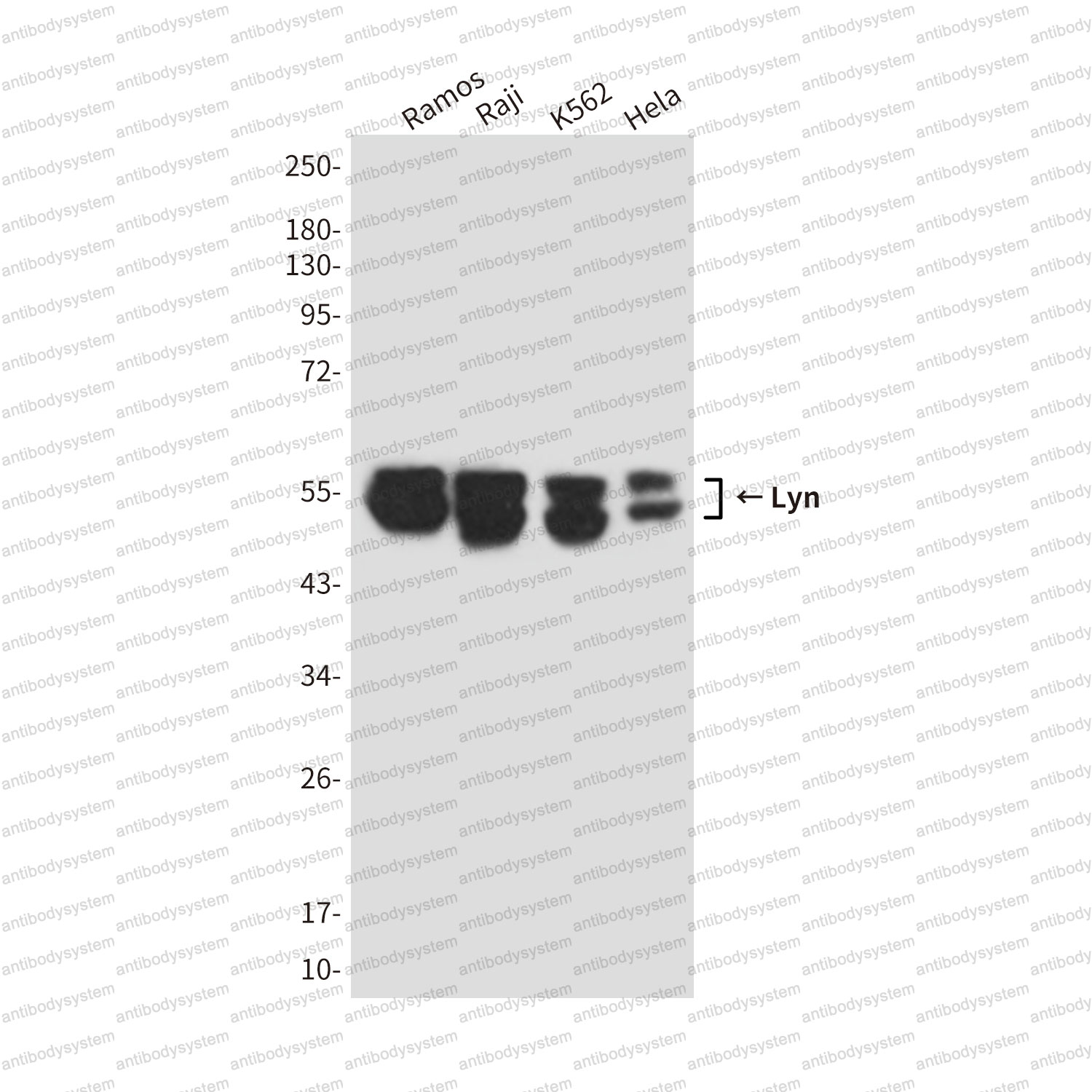 Western blot for Anti-LYN Antibody (R3A40) ?>