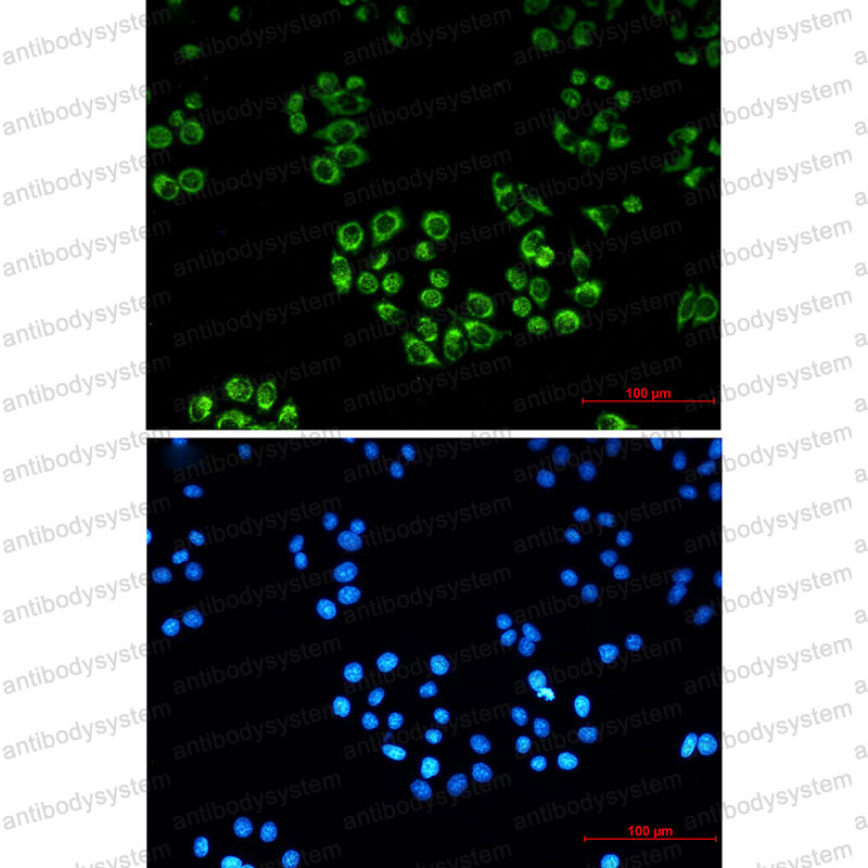 Anti-FH Antibody (R1L28)