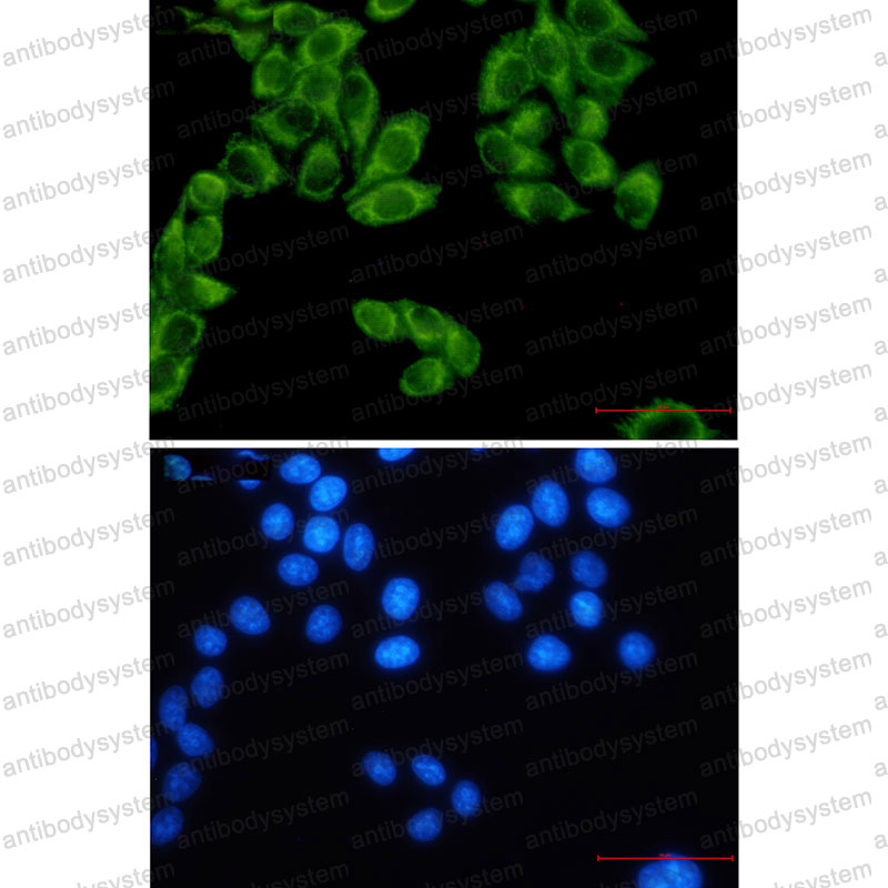 Anti-FH Antibody (R1L29)