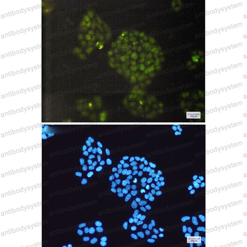 Anti-ERCC1 Antibody (R1L30)