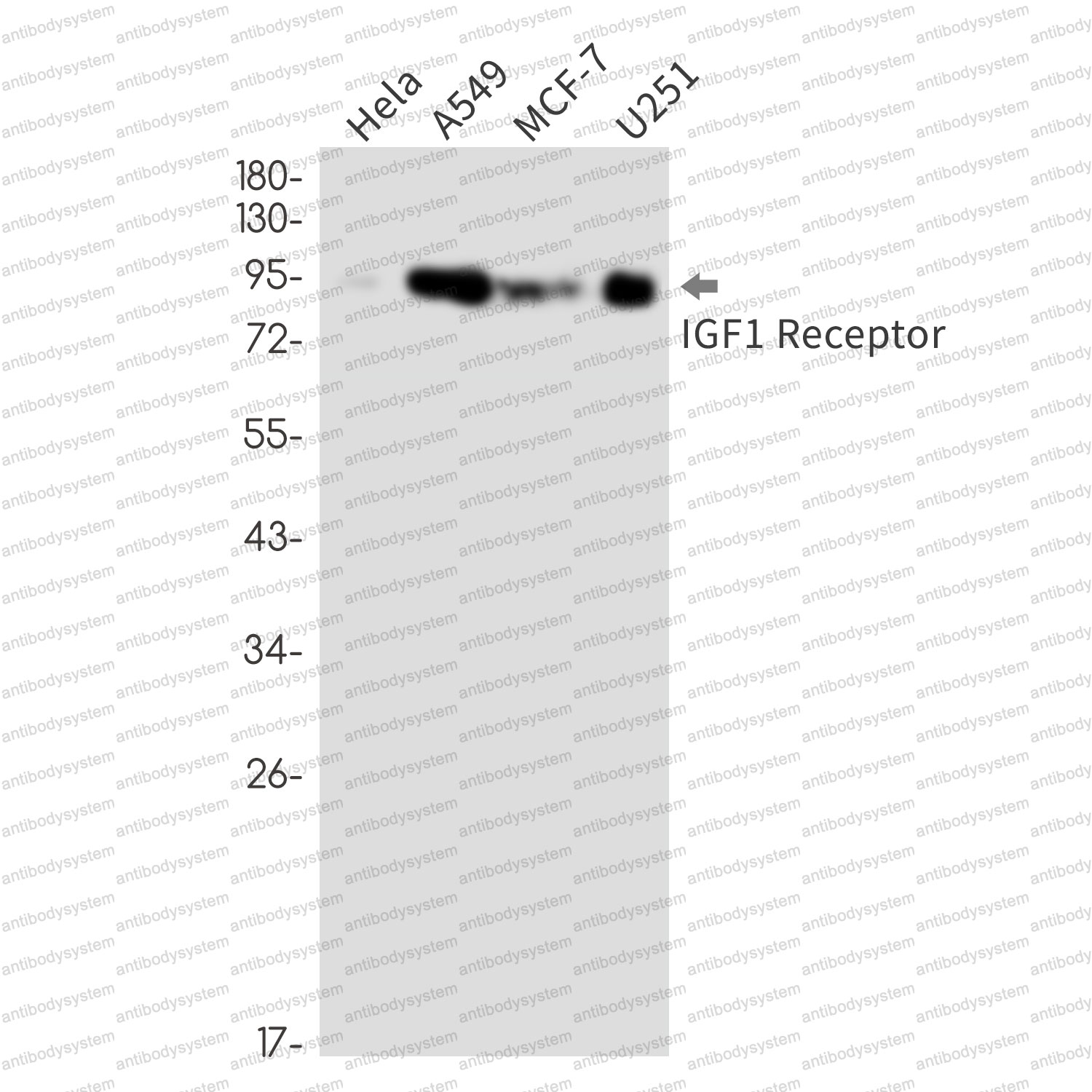 Anti-CD221/IGF1R Antibody (R1L37)