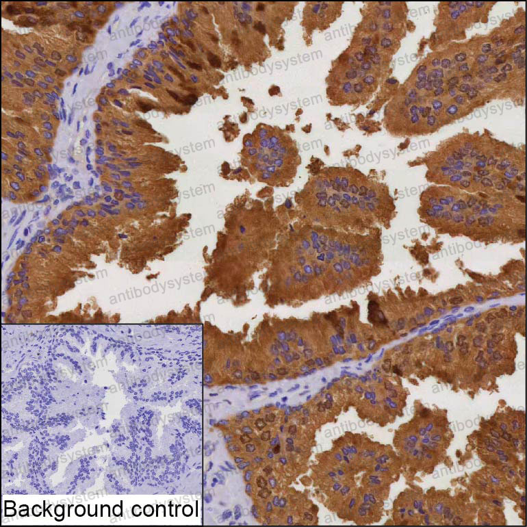 Immunohistochemical for Anti-MSMB Antibody (R3A54) ?>