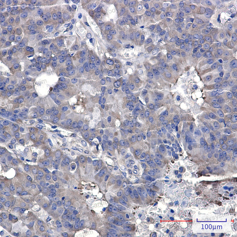 Anti-HSP90AB1 Antibody (R1L53)