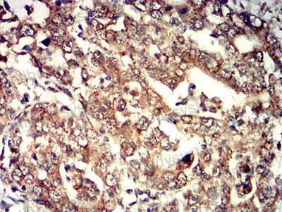 Immunohistochemical for Anti-ELANE Antibody (R3A66) ?>