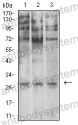 Western blot for Anti-ELANE Antibody (R3A66) ?>