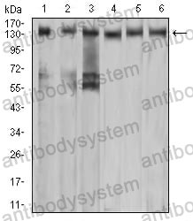 Western blot for Anti-MET/c-Met/HGFR Antibody (R3B08) ?>
