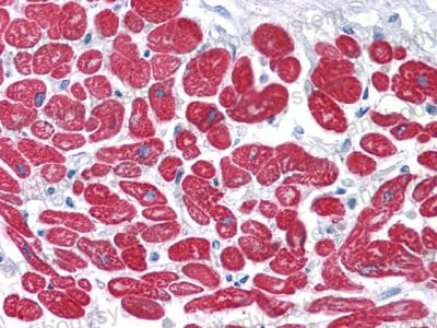 Immunohistochemical for Anti-MYL3 Antibody (R3B11) ?>