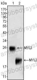 Western blot for Anti-MYL3 Antibody (R3B11) ?>