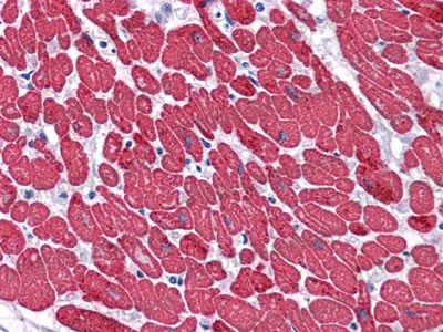 Immunohistochemical for Anti-MYL3 Antibody (R3B10) ?>