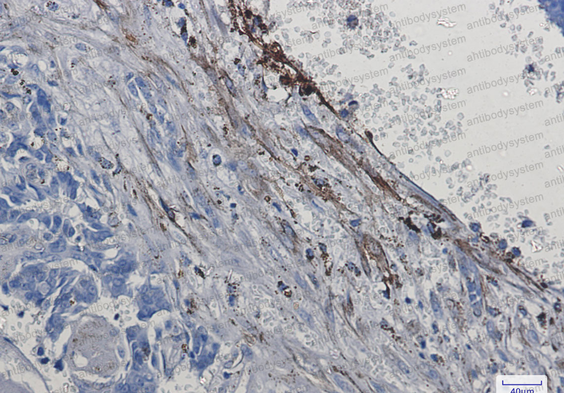 Anti-CD49e/ITGA5 Antibody (R1L73)