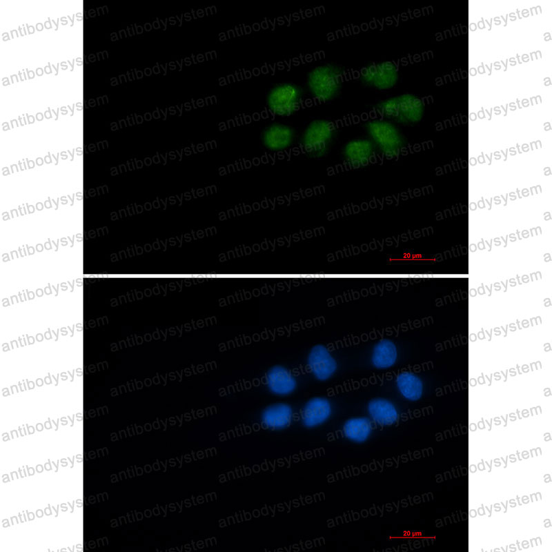 Anti-Phospho-VIM/Vimentin (Ser56) Antibody (R1L74)