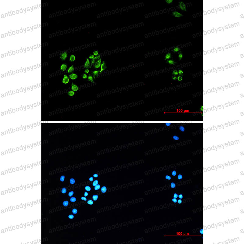 Anti-VIM/Vimentin Antibody (R1L76)