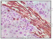 Immunohistochemical for Anti-VIM/Vimentin Antibody (R3B18) ?>
