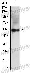 Western blot for Anti-VIM/Vimentin Antibody (R3B18) ?>