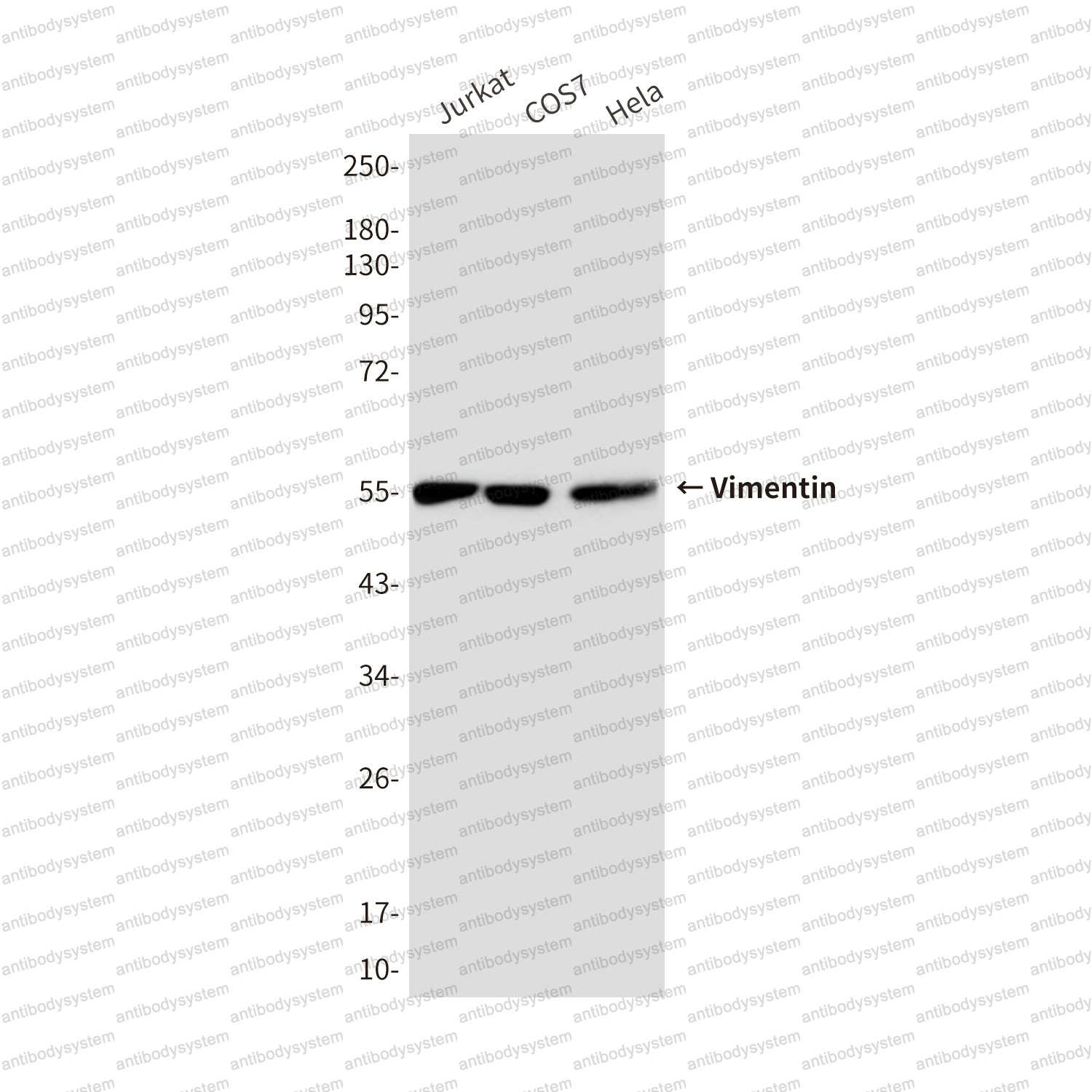 Western blot for Anti-VIM/Vimentin Antibody (R3B22) ?>