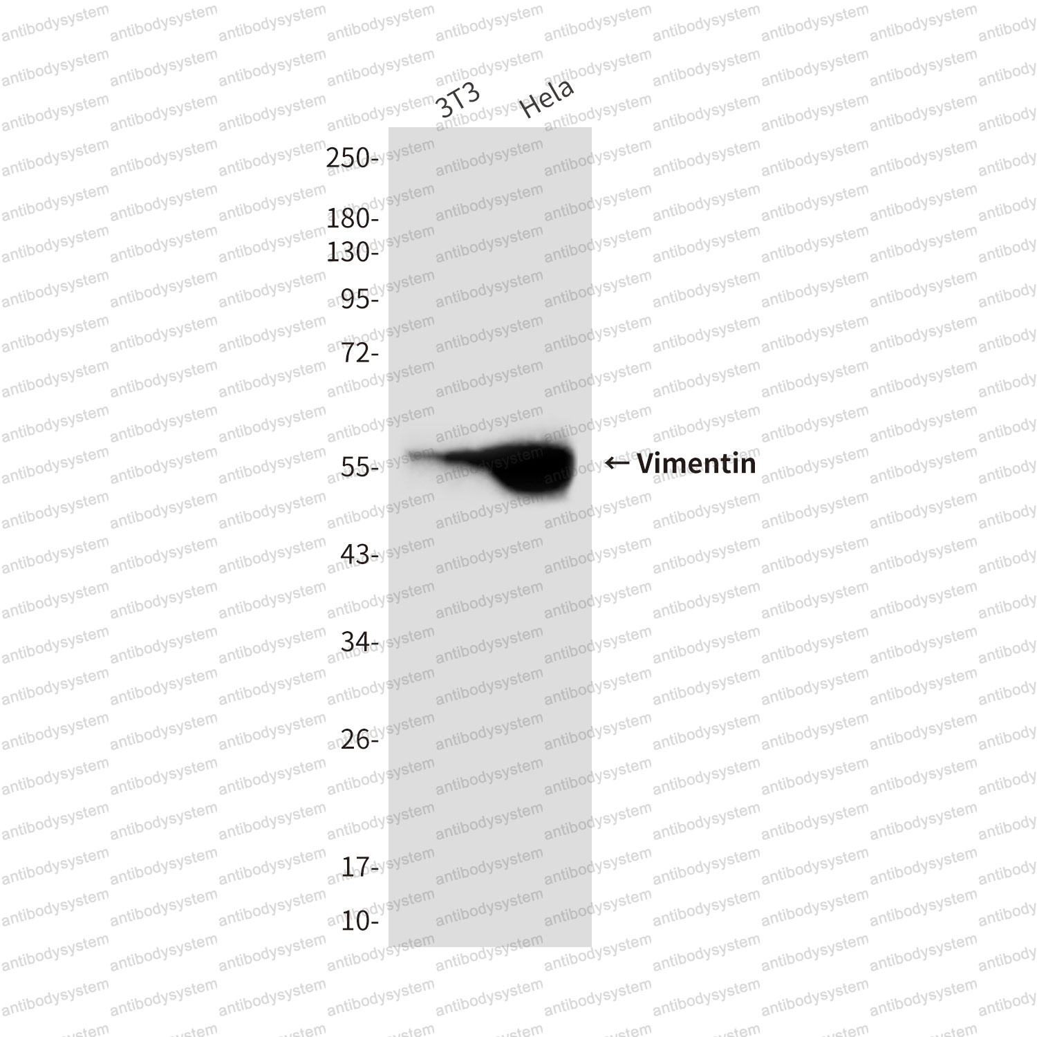 Western blot for Anti-VIM/Vimentin Antibody (R3B22) ?>