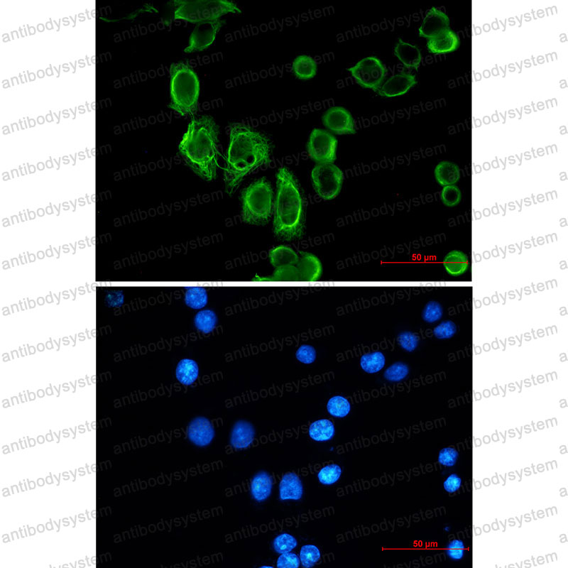 Anti-KRT19/CK19 Antibody (R1L79)