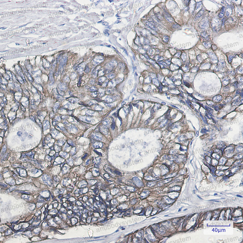Anti-KRT19/CK19 Antibody (R1L78)