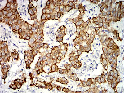 Anti-KRT19/CK19 Antibody (R3B30)