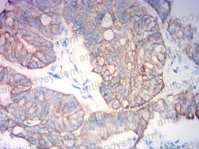 Anti-KRT19/CK19 Antibody (R3B32)