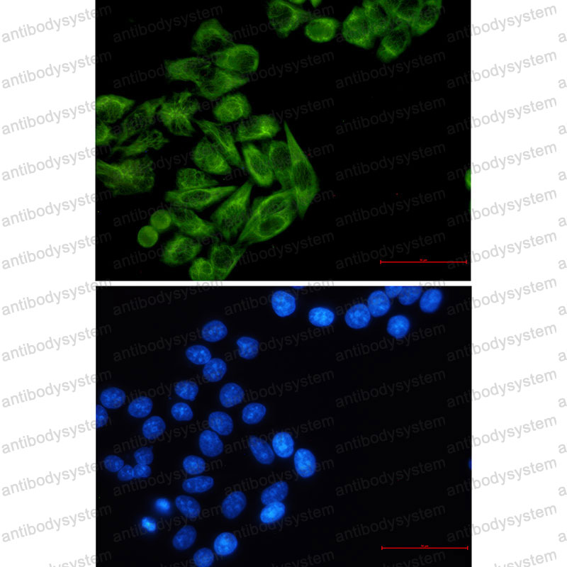 Anti-KRT7 Antibody (R1L80)