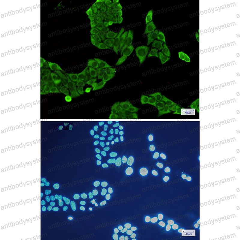 Anti-ANXA5 Antibody (R1L81)