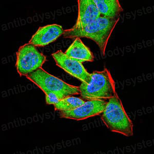 Immunofluorescence for Anti-ANXA5 Antibody (R3B38) ?>