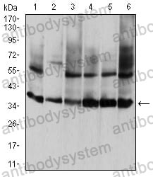 Western blot for Anti-ANXA5 Antibody (R3B38) ?>