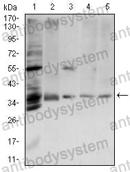 Western blot for Anti-ANXA5 Antibody (R3B37) ?>