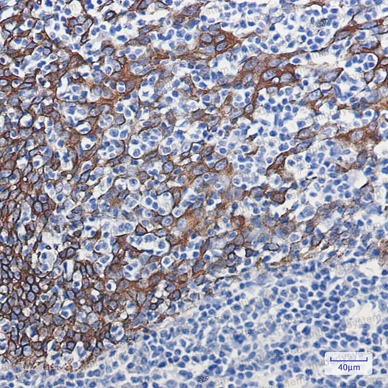 Anti-KRT16 Antibody (R1L82)