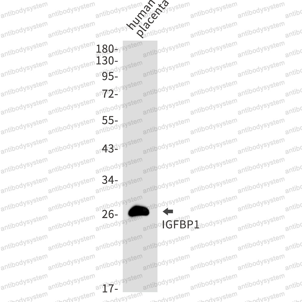 Anti-IGFBP1 Antibody (R1L84)