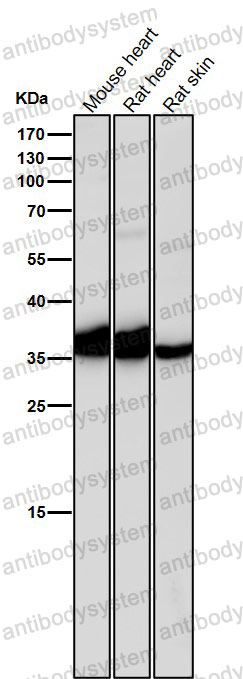 Anti-IGFBP1 Antibody (R1L83)