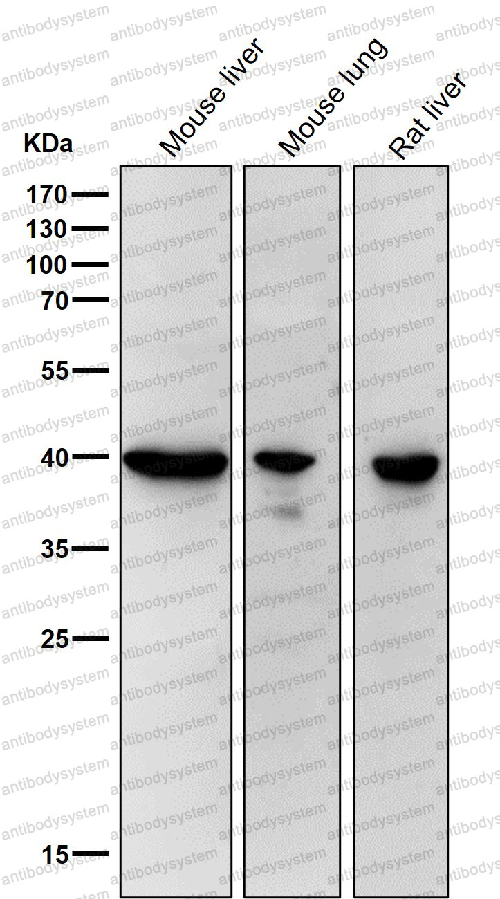 Anti-RPSA Antibody (R1L85)