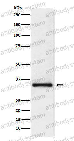 Anti-SNRPA Antibody (R1L89)