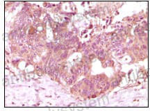 Immunohistochemical for Anti-FGF2/FGFb Antibody (R3B46) ?>