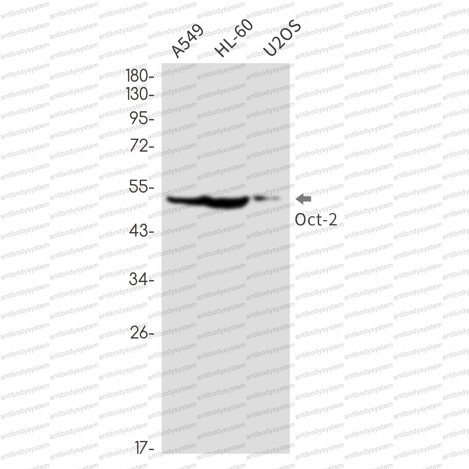 Anti-POU2F2 Antibody (R1L93)