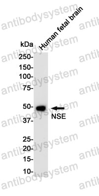 Anti-ENO2/NSE Antibody (R1L94)