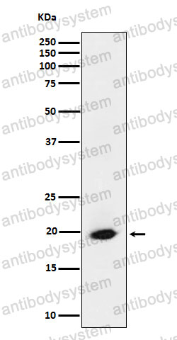 Anti-SRP19 Antibody (R1L95)