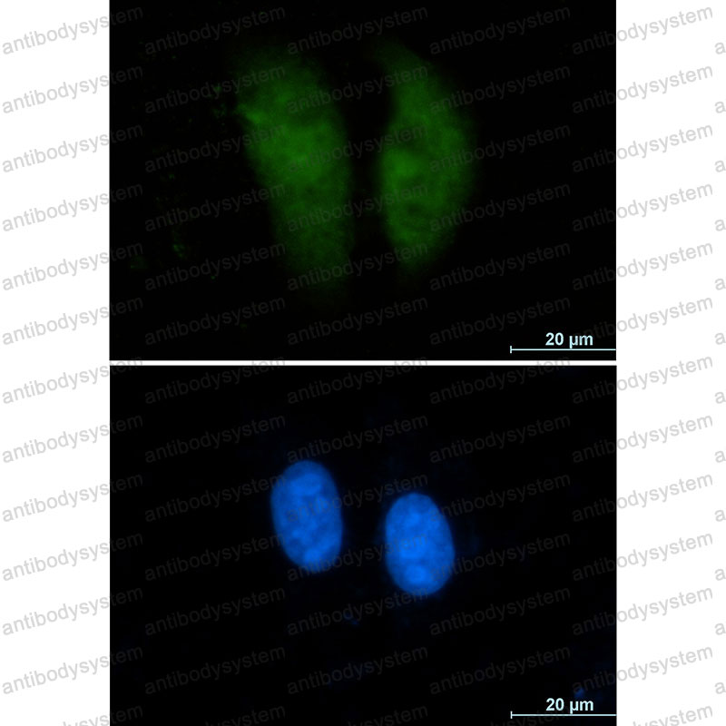 Anti-GSTP1 Antibody (R1L97)