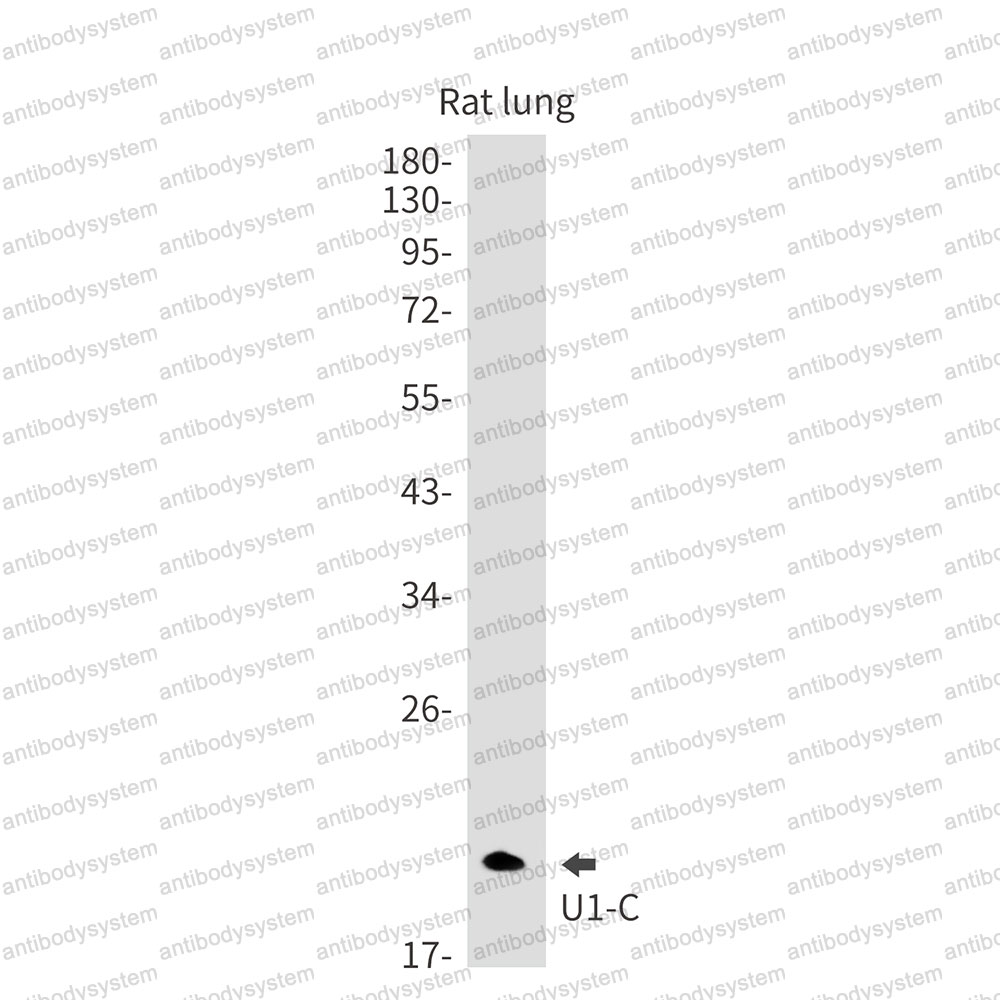 Anti-SNRPC Antibody (R1L98)