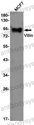 Anti-VIL1 Antibody (R1M01)