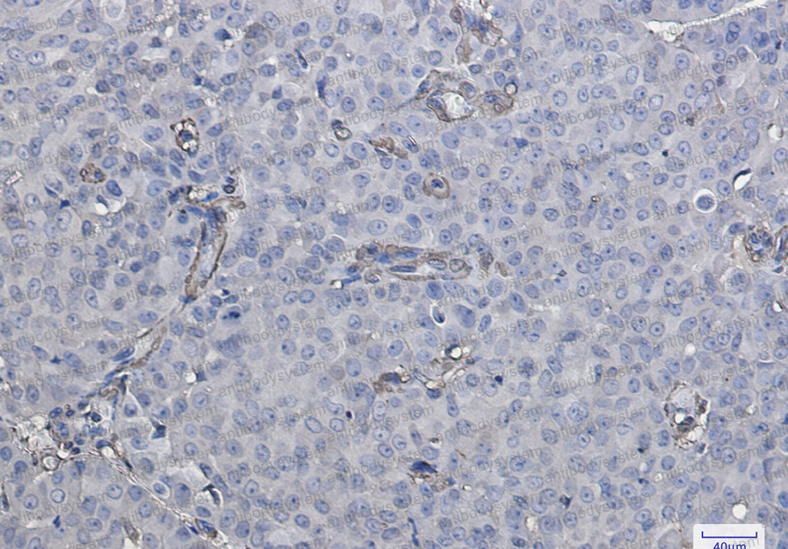Anti-Gal1/LGALS1 Antibody (R1M02)