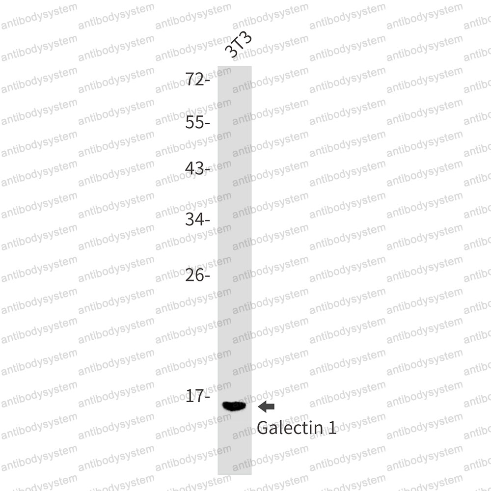 Anti-Gal1/LGALS1 Antibody (R1M03)