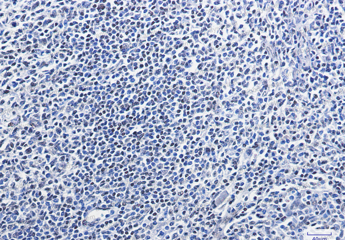 Anti-HMGB1 Antibody (R1M04)