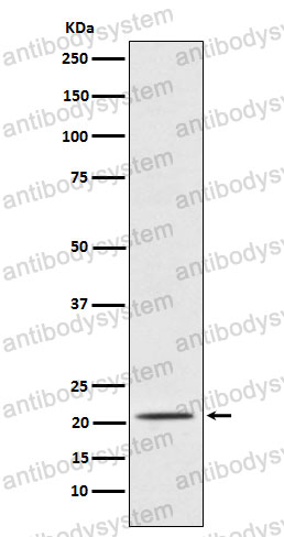 Anti-PAEP/PP14 Antibody (R1M05)